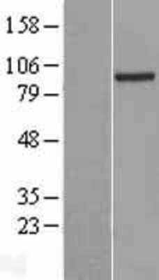 Western Blot: PRDM4 Overexpression Lysate (Adult Normal) [NBL1-14736] Left-Empty vector transfected control cell lysate (HEK293 cell lysate); Right -Over-expression Lysate for PRDM4.