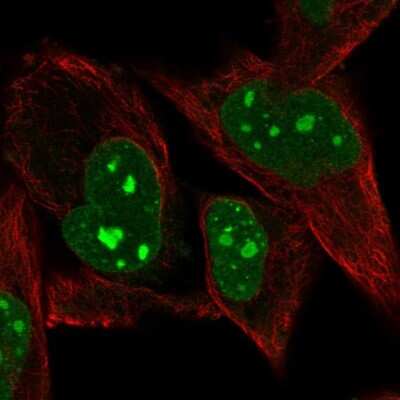 <b>Orthogonal Strategies Validation. </b>Immunocytochemistry/Immunofluorescence: PRDM5 Antibody [NBP2-13810] - Staining of human cell line RH-30 shows localization to nucleus, nucleoli & nuclear bodies.
