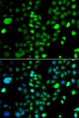 Immunocytochemistry/ Immunofluorescence PRDM5 Antibody - BSA Free
