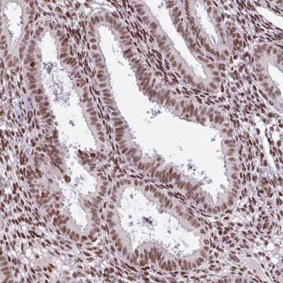 Immunohistochemistry-Paraffin: PRDM5 Antibody [NBP2-13810] - Staining of human endometrium shows high expression.