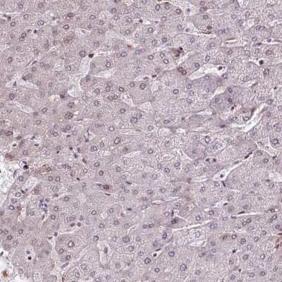 Immunohistochemistry-Paraffin: PRDM5 Antibody [NBP2-13810] - Staining of human liver shows low expression as expected.