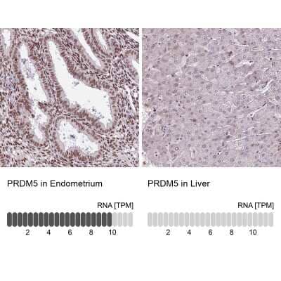 Immunohistochemistry-Paraffin: PRDM5 Antibody [NBP2-13810] - Staining in human endometrium and liver tissues using anti-PRDM5 antibody. Corresponding PRDM5 RNA-seq data are presented for the same tissues.