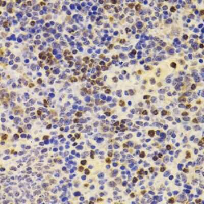 Immunohistochemistry-Paraffin PRDM5 Antibody - BSA Free