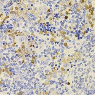 Immunohistochemistry-Paraffin PRDM5 Antibody - BSA Free