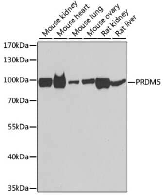 Western Blot PRDM5 Antibody - BSA Free