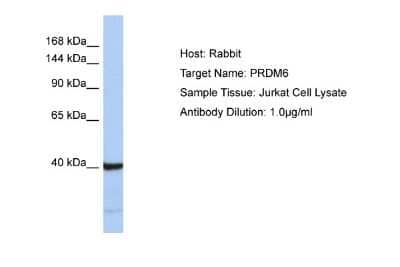 Western Blot: PRDM6 Antibody [NBP2-83416] - Host: Rabbit. Target Name: PRDM6. Sample Type: Jurkat Whole Cell lysates. Antibody Dilution: 1.0ug/ml