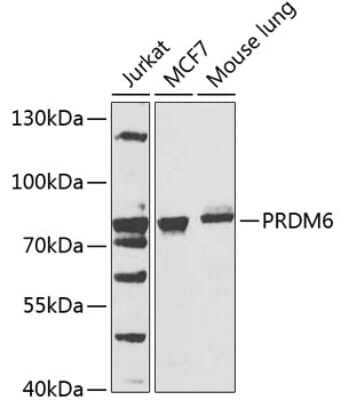 Western Blot: PRDM6 Antibody [NBP2-94313] - Analysis of extracts of various cell lines, using PRDM6 at 1:1000 dilution. Secondary antibody: HRP Goat Anti-Rabbit IgG (H+L) at 1:10000 dilution. Lysates/proteins: 25ug per lane. Blocking buffer: 3% nonfat dry milk in TBST. Detection: ECL Basic Kit . Exposure time: 90s.