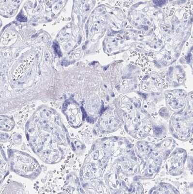 Immunohistochemistry-Paraffin: PRDM7 Antibody [NBP2-32504] - Staining of human placenta shows no positivity in trophoblastic cells as expected.