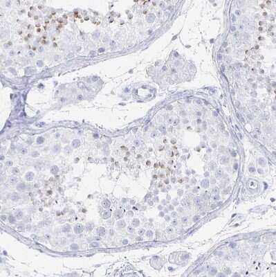 Immunohistochemistry-Paraffin: PRDM7 Antibody [NBP2-32504] - Staining of human testis shows moderate cytoplasmic positivity in acrosomes.