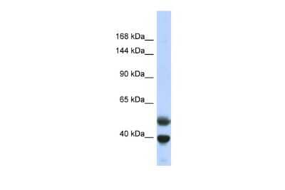 Western Blot: PRDM7 Antibody [NBP2-83417] - Host: Rabbit. Target Name: PRDM7. Sample Type: Fetal Lung lysates. Antibody Dilution: 1.0ug/ml