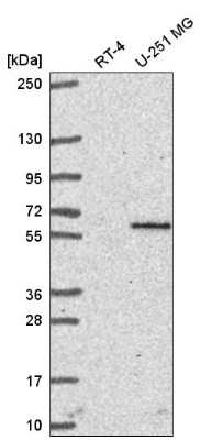 Western Blot: PRDM8 Antibody [NBP2-58446] - Analysis in human cell line RT-4 and human cell line U-251 MG.