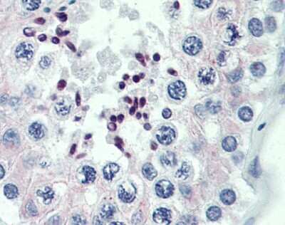 Immunohistochemistry: PRDM9 Antibody [NBP1-80118] - Analysis of human testis after heat-induced Antigen retrieval. Antibody concentration 5 ug/ml.