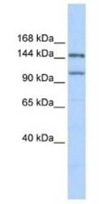 Western Blot: PRDM9 Antibody [NBP1-80118] - 293T Cell Lysate 1ug/ml Gel Concentration 6-18%