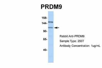 Western Blot: PRDM9 Antibody [NBP1-80118] - Sample Type: 293T Antibody Dilution: 1.0 ug/ml