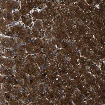 Immunohistochemistry-Paraffin: PREB Antibody [NBP1-87057] - Staining of human liver shows strong cytoplasmic positivity in hepatocytes.