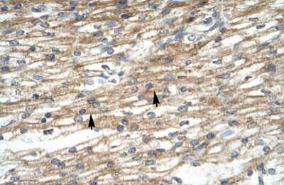 Immunohistochemistry-Paraffin: PREB Antibody [NBP3-10311] - Immunohistochemical analysis of paraffin-embedded human cardiac cell tissue.