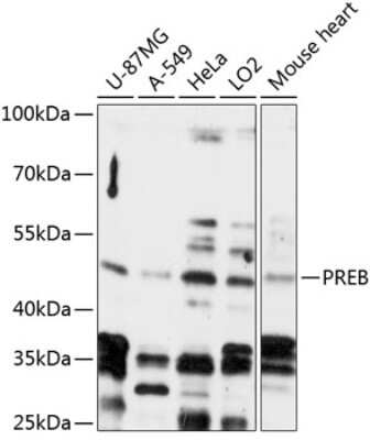 Western Blot: PREB Antibody [NBP3-04673] - Analysis of extracts of various cell lines, using PREB antibody at 1:3000 dilution. Secondary antibody: HRP Goat Anti-Rabbit IgG (H+L) at 1:10000 dilution. Lysates/proteins: 25ug per lane. Blocking buffer: 3% nonfat dry milk in TBST. Detection: ECL Enhanced Kit
