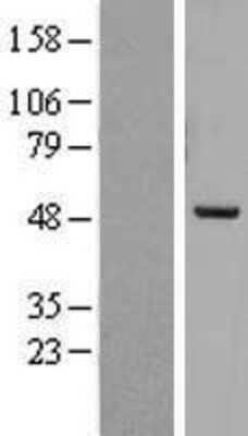 Western Blot: PREB Overexpression Lysate (Adult Normal) [NBL1-14744] Left-Empty vector transfected control cell lysate (HEK293 cell lysate); Right -Over-expression Lysate for PREB.