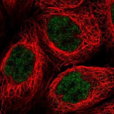 Immunocytochemistry/Immunofluorescence: PRELID2 Antibody [NBP1-81937] - Immunofluorescent staining of human cell line A-431 shows localization to nucleoplasm.