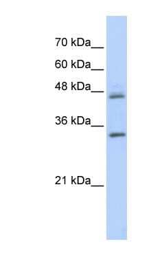 Western Blot: PRELP Antibody [NBP1-79627] - Titration: 0.2-1 ug/ml, Positive Control: Transfected 293T.