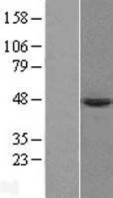 Western Blot PRELP Overexpression Lysate