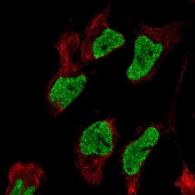Immunocytochemistry/Immunofluorescence: PRG-3 Antibody [NBP2-58414] - Staining of human cell line AF22 shows localization to nucleoplasm.