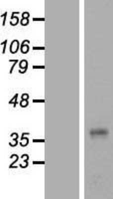 Western Blot: PRG-3 Overexpression Lysate (Adult Normal) [NBL1-14751] Left-Empty vector transfected control cell lysate (HEK293 cell lysate); Right -Over-expression Lysate for PRG-3.