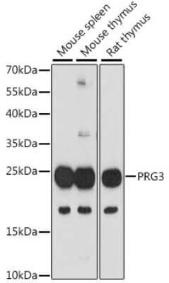 Western Blot: PRG3 Antibody [NBP2-94548] - Analysis of extracts of various cell lines, using PRG3 at 1:1000 dilution. Secondary antibody: HRP Goat Anti-Rabbit IgG (H+L) at 1:10000 dilution. Lysates/proteins: 25ug per lane. Blocking buffer: 3% nonfat dry milk in TBST. Detection: ECL Basic Kit . Exposure time: 90s.