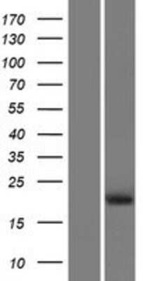 Western Blot PRHOXNB Overexpression Lysate