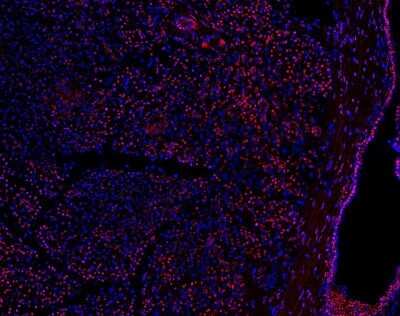 Immunocytochemistry/Immunofluorescence: PRICKLE1 Antibody [NBP1-83967] - Staining of human pancreatic frozen tissue sections stained with PRICKLE1 antibody (red). Nuclei labeled with DAPI (blue). Image from verified customer review.