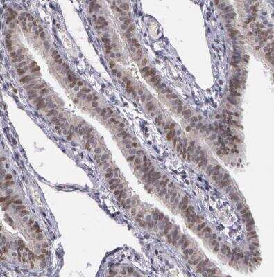 Immunohistochemistry-Paraffin: PRICKLE1 Antibody [NBP1-83967] - Staining of human fallopian tube shows weak to moderate nuclear positivity in glanular cells.
