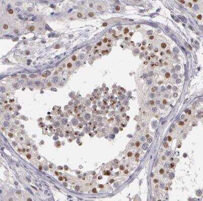 Immunohistochemistry-Paraffin: PRICKLE1 Antibody [NBP1-83967] - Staining of human testis shows moderate nuclear postivity in cells in seminiferous ducts.