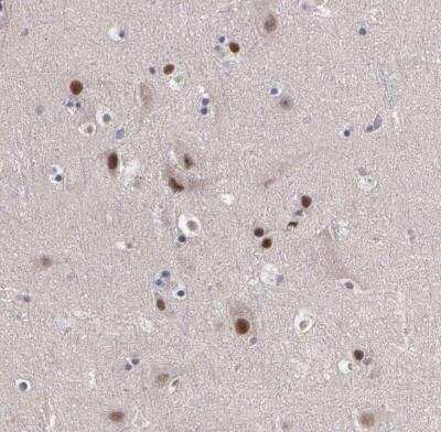 Immunohistochemistry-Paraffin: PRICKLE1 Antibody [NBP1-83967] - Staining of human cerebral cortex shows moderate strong nuclear positivity in neurons.