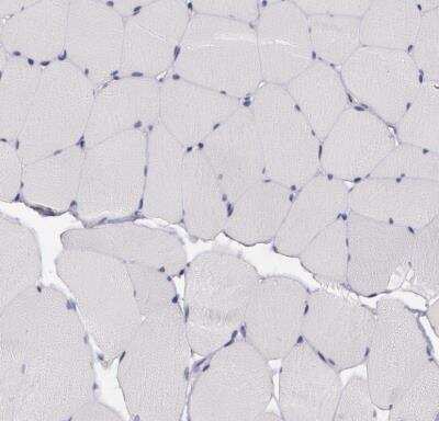 Immunohistochemistry-Paraffin: PRICKLE1 Antibody [NBP1-83967] - Staining of human skeletal muscle shows no postivity in myocytes as expected.