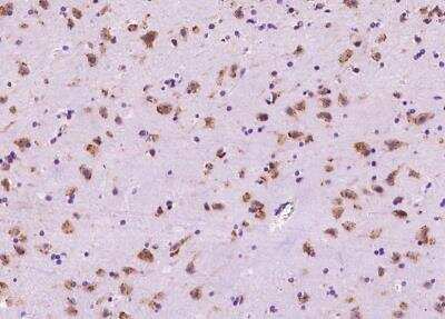 Immunohistochemistry-Paraffin: PRICKLE2 Antibody [NBP3-06515] - Staining of human PRICKLE2 in human brain with rabbit polyclonal antibody at 1:300 dilution.