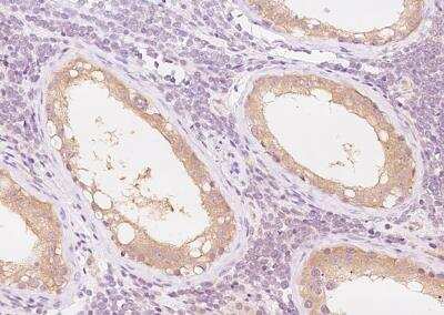 Immunohistochemistry-Paraffin: PRICKLE2 Antibody [NBP3-06515] - Staining of human PRICKLE2 in human testis with rabbit polyclonal antibody at 1:300 dilution.