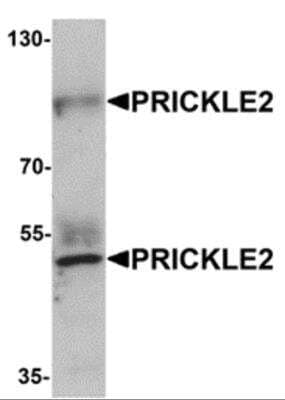 Western Blot: PRICKLE2 Antibody [NBP2-81938] - Analysis of PRICKLE2 in A-20 lysate with PRICKLE2 antibody at 1 ug/ml.