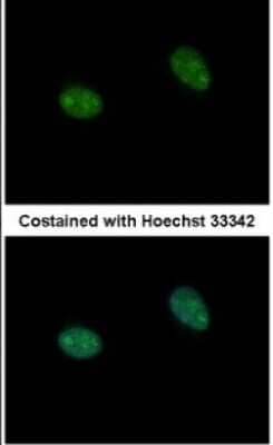 Immunocytochemistry/Immunofluorescence: PRICKLE3 Antibody [NBP1-33511] - Paraformaldehyde-fixed HeLa, using antibody at 1:500 dilution.