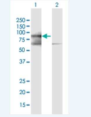 Western Blot: PRICKLE3 Antibody [H00004007-B01P-50ug] - Analysis of PRICKLE3 expression in transfected 293T cell line  H00004007-T01) by PRICKLE3 MaxPab polyclonal antibody.  Lane 1: PRICKLE3 transfected lysate(67.65 KDa). Lane 2: Non-transfected lysate.