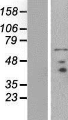 Western Blot: PRICKLE3 Overexpression Lysate (Adult Normal) [NBP2-07661] Left-Empty vector transfected control cell lysate (HEK293 cell lysate); Right -Over-expression Lysate for PRICKLE3.