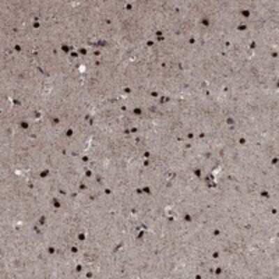 Immunohistochemistry-Paraffin PRICKLE4 Antibody - BSA Free