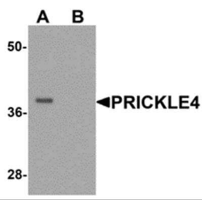 Western Blot PRICKLE4 Antibody - BSA Free