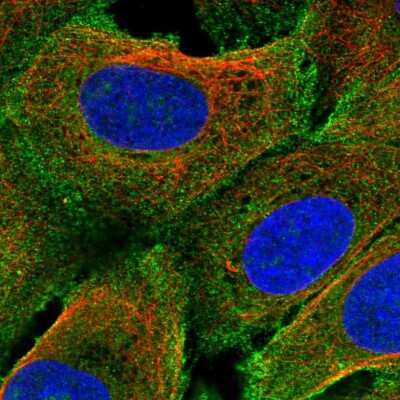 Immunocytochemistry/Immunofluorescence: PRIMA1 Antibody [NBP2-56671] - Staining of human cell line U-2 OS shows localization to nucleoli & plasma membrane.