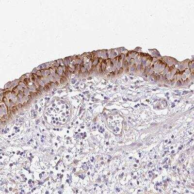 Immunohistochemistry-Paraffin: PRIMA1 Antibody [NBP2-32508] - Staining of human urinary bladder shows strong cytoplasmic positivity in urothelial cells.