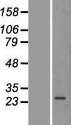 Western Blot: AMPK beta 2/PRKAB2 Overexpression Lysate [NBP2-07757] -  Left-Empty vector transfected control cell lysate (HEK293 cell lysate); Right -Over-expression Lysate for PRKAB2.