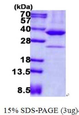 SDS-Page: Recombinant Human AMPK beta 2/PRKAB2 Protein [NBP2-23376]