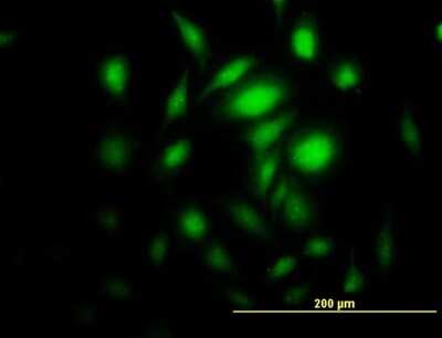 Immunocytochemistry/Immunofluorescence: PRKAG2 Antibody [H00051422-B01P] - Analysis of purified antibody to PRKAG2 on HeLa cell. (antibody concentration 10 ug/ml)