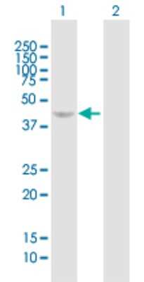 Western Blot: PRKAG2 Antibody [H00051422-B01P] - Analysis of PRKAG2 expression in transfected 293T cell line by PRKAG2 polyclonal antibody.  Lane 1: PRKAG2 transfected lysate(36.08 KDa). Lane 2: Non-transfected lysate.