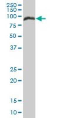 Western Blot: PRKCSH Antibody [H00005589-B01P] - Analysis of PRKCSH expression in human liver.