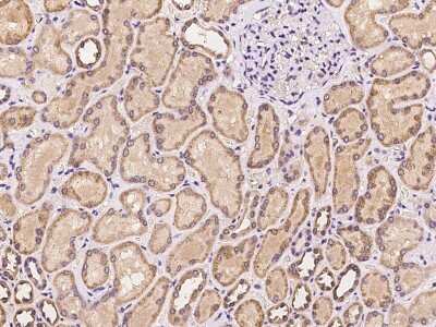 Immunohistochemistry-Paraffin: PRKD3/nPKC nu Antibody [NBP2-97269] - Immunochemical staining of human PRKD3/nPKC nu in human kidney with rabbit polyclonal antibody at 1:100 dilution, formalin-fixed paraffin embedded sections.